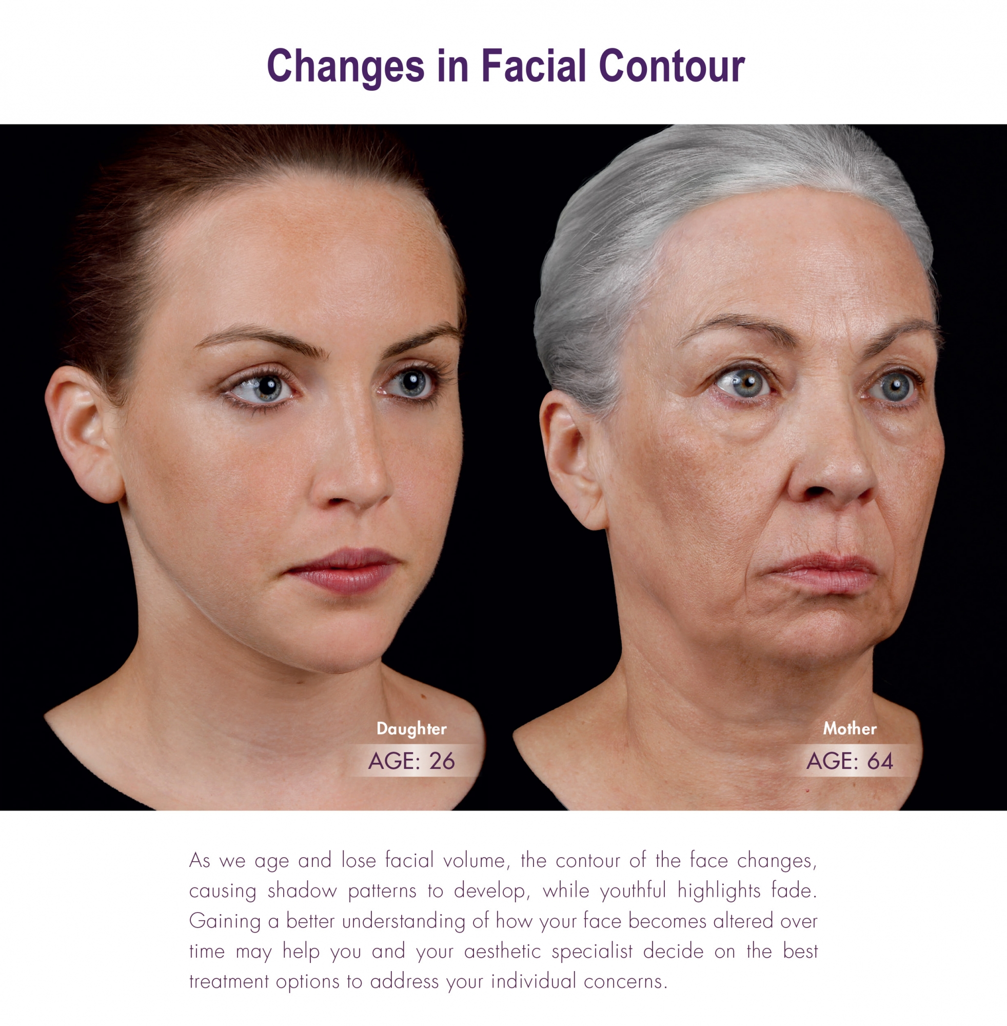 changes in facial contour with age - learn how Juvederm can help!